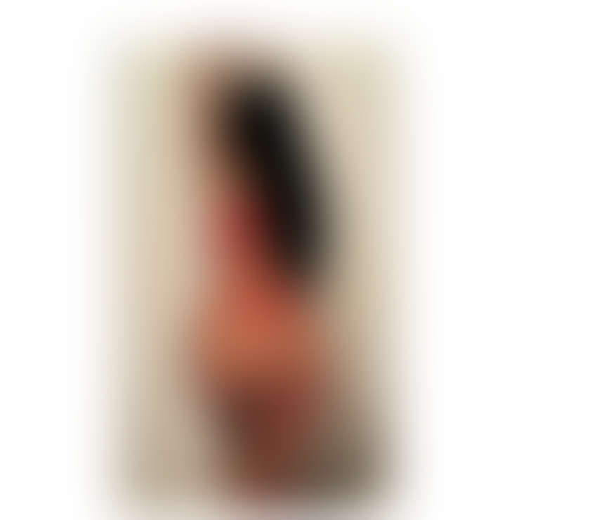 Escorts East London Hackney - East London - Photos for Eve 🫶New in Town🫶Best Service 👅24 7